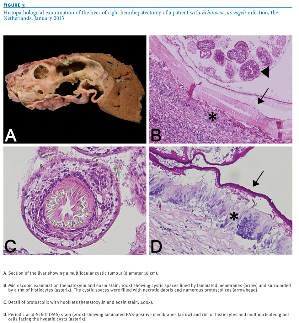 echinococcus-granulosus-dog-tapeworm-online-biology-notes